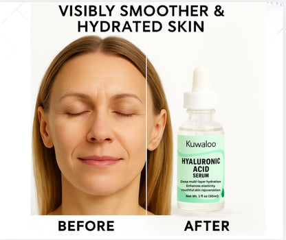 Hyaluronic Acid Serum
